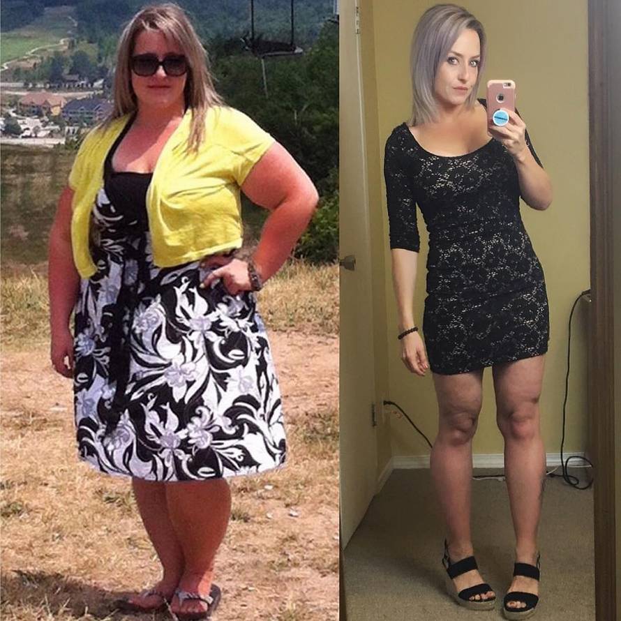 Izgubila 70 kg pa našla ljubav: 'Spojilo nas je 'skidanje' kila...'