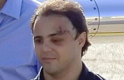 F. Massa na kućnoj njezi: Nesreća je ostavila ožiljak