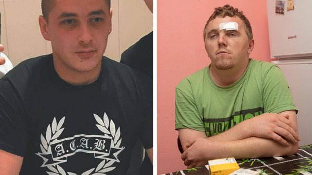 Mlađem Culeju i trojici počeli su suditi za napad na mladića (23): 'Oslijepio sam zbog batinanja'