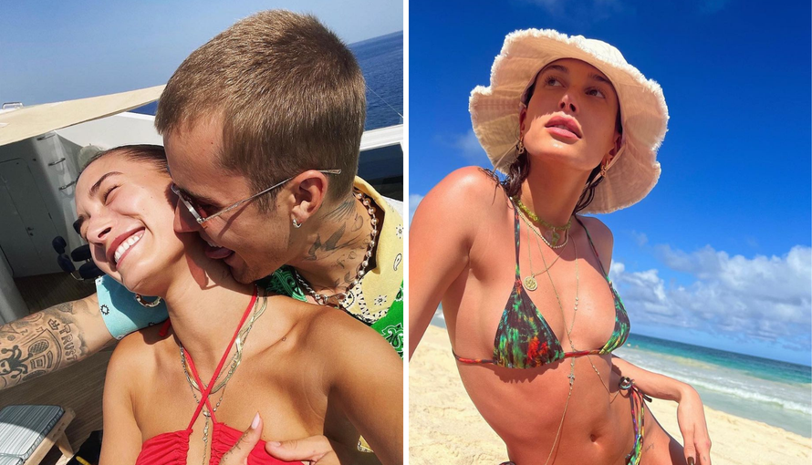 Hailey Bieber hospitalizirali radi problema na mozgu, liječnici tvrde da su povezani s koronom