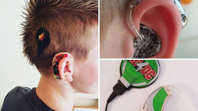 Za sina koji ima problema sa sluhom radi ukrasne slušne aparatiće: Vole ih i druga djeca