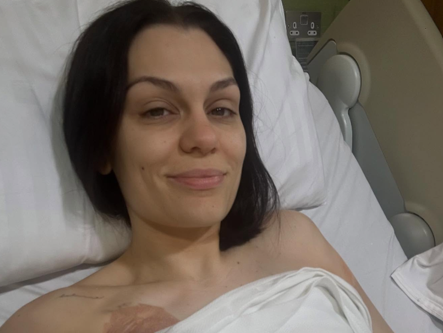 Jessie J ide na drugu operaciju nakon što je pobijedila rak