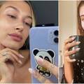 Hailey Bieber otkrila: Mom licu slana voda najbolje odgovara