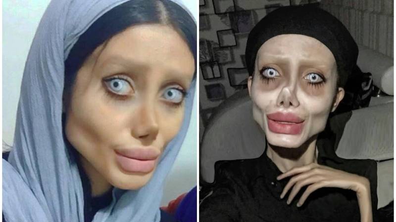 FOTO Sjećate se iranske 'zombi Angeline Jolie'? Ovako izgleda zapravo, a evo i zašto je nestala