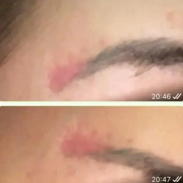 Ovo su žrtve estetskog kirurga iz Zagreba. Htio ih je ušutkati. Stigla mu je prva kazna