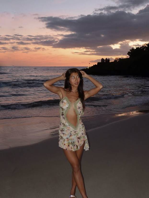 FOTO Mlada manekenka svoju 'nesigurnost' pretvorila u posao iz snova: 'To mi je najveći adut'