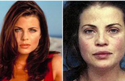 Prije i poslije: Ovim zvijezdama su teške ovisnosti uništile lica