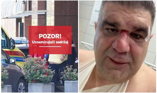 Svjedok tučnjave Srba ispred Sheratona: Sve je bilo mirno dok nije spomenuo Cecu