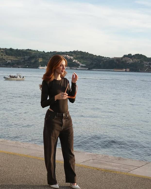 FOTO Posebna ljepota: Milijuni ljudi obožavaju njezine pjegice