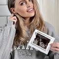 Manekenka Carla šokirala svijet: 'Tko plati, može gledati prijenos mog poroda'