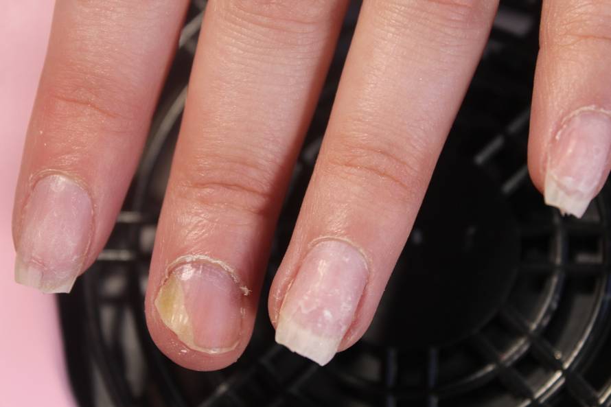 Nokti su vam slabi? Ojačajte ih uz ovih 11 prirodnih načina...