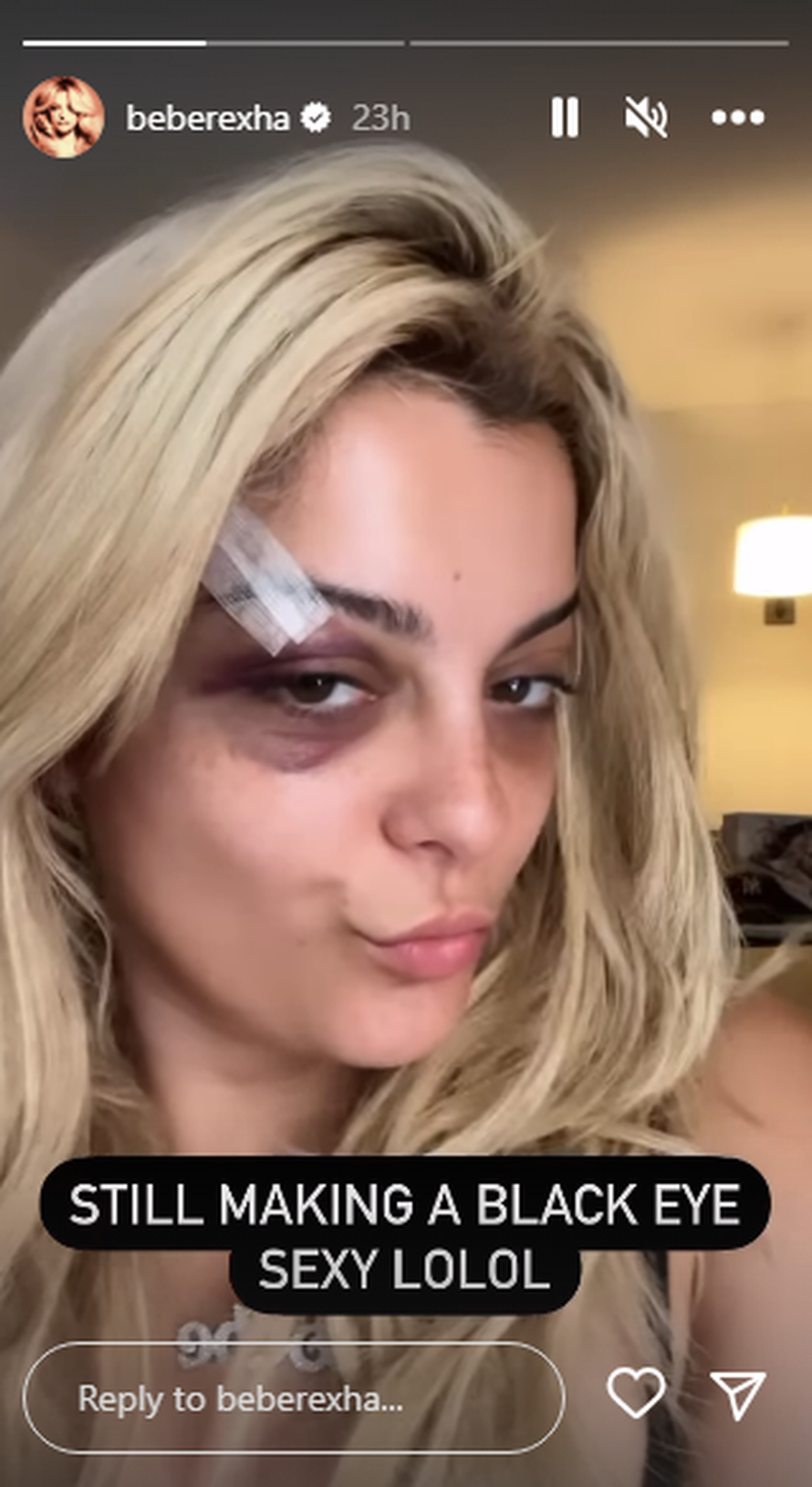 Još jedna pjevačica pogođena je na koncertu: Iz publike joj u lice doletjelo pirotehničko sredstvo