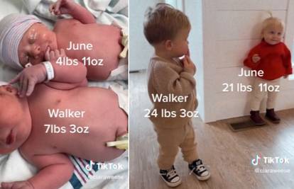 'Liječnici kažu da nikad još nisu vidjeli takvu razliku u veličini beba kao kod mojih blizanaca'