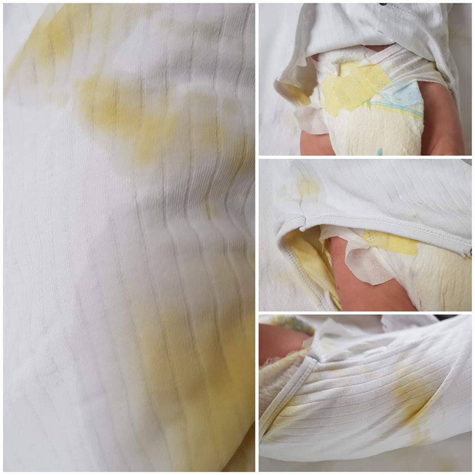Objavila šokantne slike beba u ranama iz zagrebačke bolnice