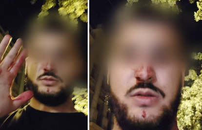 Napadnut taksist u Zagrebu: 'Udarao me šakom, lovio oko auta i vikao mi da sam Cigan'