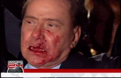 Krvavim licem Berlusconi poziva članove u stranku