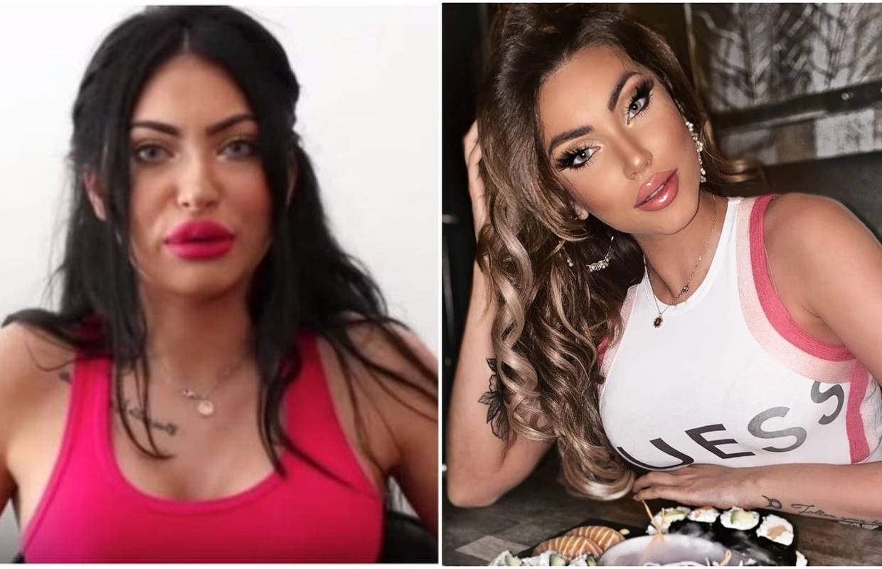 'Radila sam filere. Prvi put da vam kažem jer sam zadovoljna'