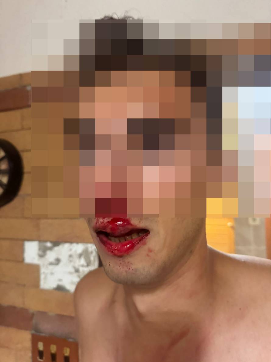 Zaštitari u Savudriji brutalno su istukli Slovence! Nisu ih priveli! Policija: Nismo imali osnove...