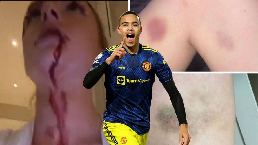 Ovo je odvratno! Audiosnimka na kojoj se čuje kako zvijezda Man. Uniteda tjera curu na seks