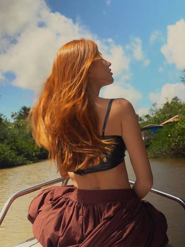 FOTO Posebna ljepota: Milijuni ljudi obožavaju njezine pjegice