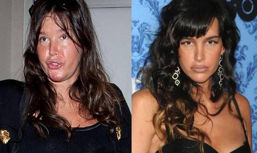 Što je napravila od sebe? Paz se udebljala, lice joj je nateklo...