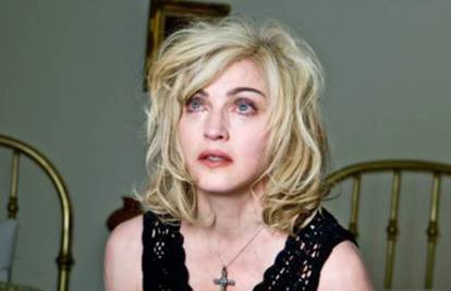 Eto zašto Madonna uvijek nosi rukavice: Trudi se sakriti vene