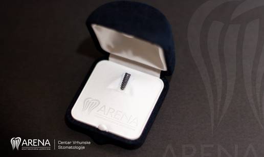 Do&zcaron;ivotno jamstvo na prekrasan osmijeh