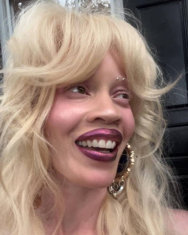 FOTO Afrikanka s albinizmom osvaja modnu industriju: 'Često privlačim znatiželjne poglede'