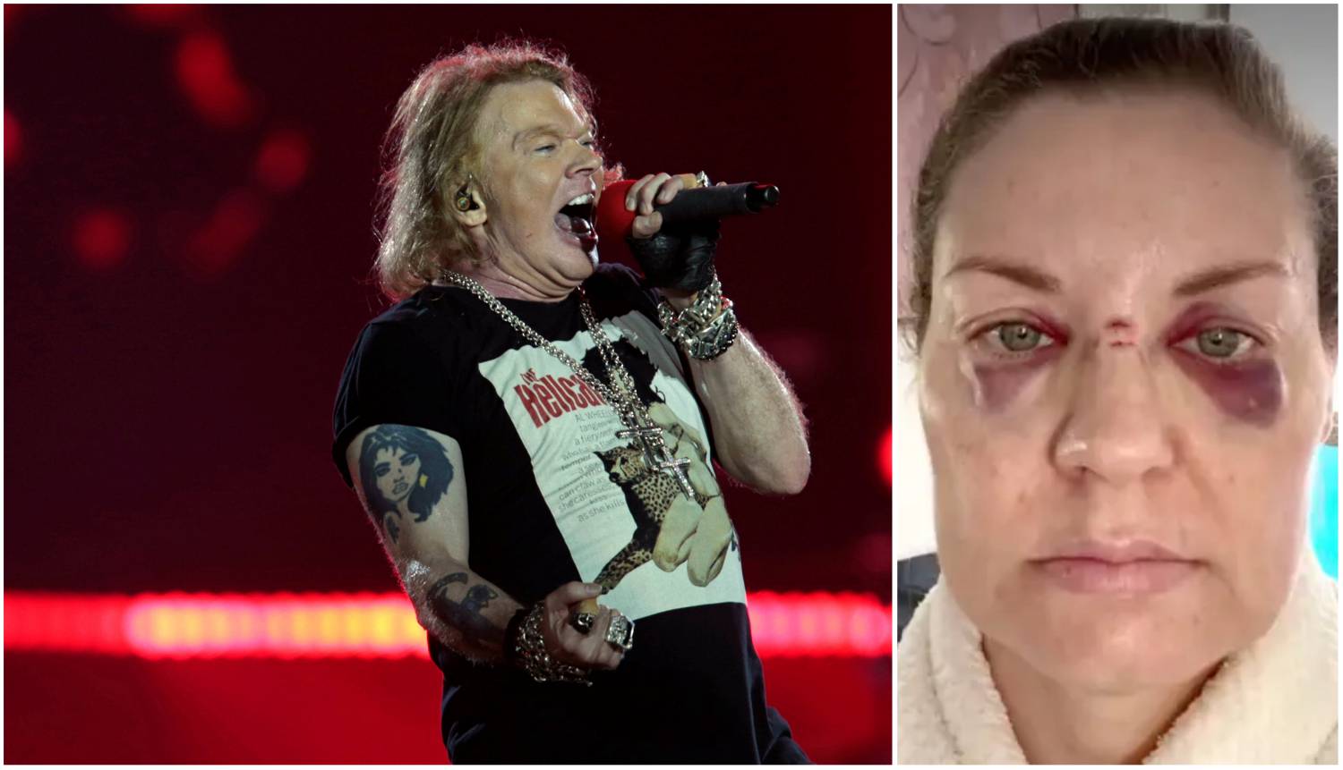 Axl Rose mikrofonom pogodio obožavateljicu: Prvo se ispričao pa obećao da se neće ponoviti