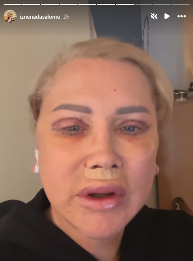 FOTO Prva je u Hrvatskoj pričala o promjeni spola: Salome je išla na facelifting, evo kako izgleda