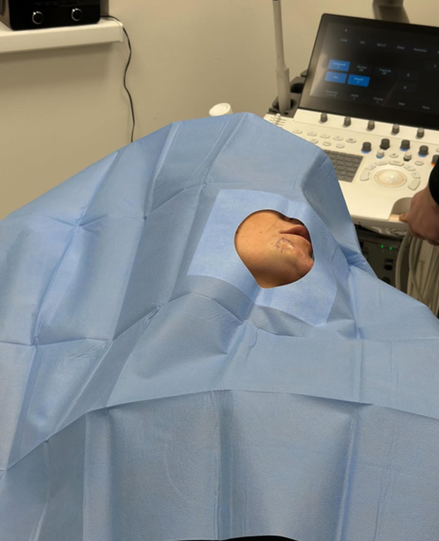 FOTO Ove slavne dame išle su pod nož: Neke su zablistale, drugima su zahvati uništili lice