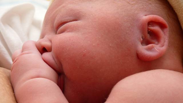 Teže bebe sklonije su kožnim ekcemima, alergijama na hranu