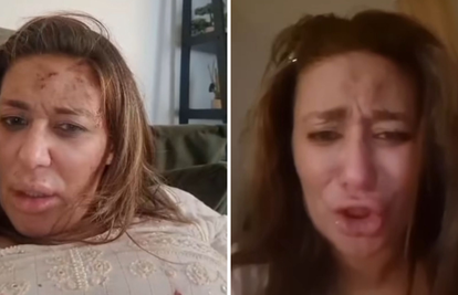 UZNEMIRUJUĆE Pjevačica Ana Nikolić pretučena: Zapomagala u suzama i u krvavoj majici...