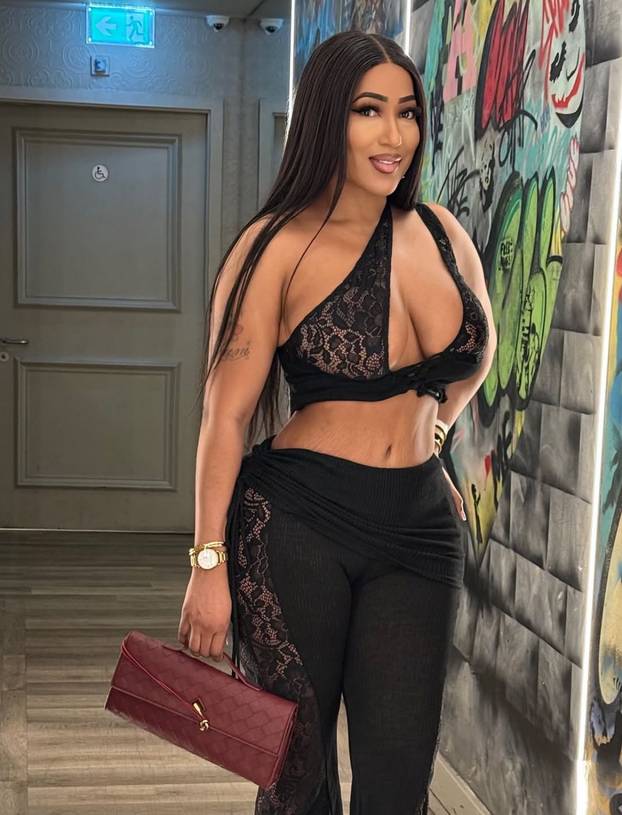 FOTO Opsjednuta estetskim operacijama: 'Želim imati stražnjicu poput Nicki Minay!'