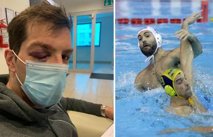 Vaterpolist Juga ozlijedio igrača Mladosti: Poslao ga u bolnicu!