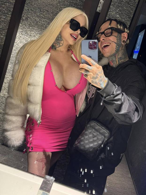 FOTO Želi imati najveće grudi na svijetu, a sad pati: 'Ne želim ih smanjiti! Ali doktori govore...'