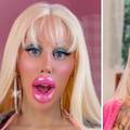 Potrošila 120.000 € da bi bila Barbie. Fotkom iz mladosti sad je šokirala: 'To nije ista osoba!'