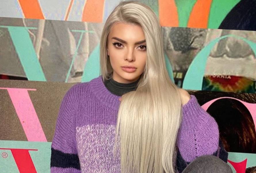 Ella ubrizgala botoks u lice pa razočarala fanove: Bila si tako prirodna, sad ličiš na sve ostale!