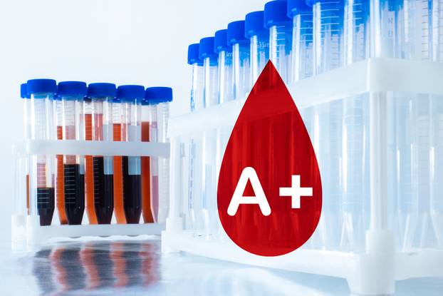 Medical blood tests. Empty test tubes and tubes of blood. Contai