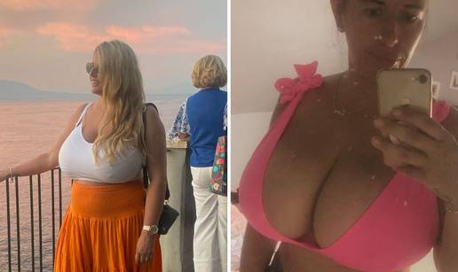 FOTO 'Morala sam smanjiti ove mega-grudi! Ljudi su  buljili u mene, a tek komentari žena...'