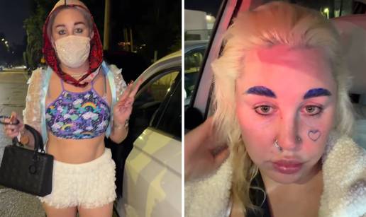 Posrnula dje&ccaron;ja zvijezda otkrila: 'Smr&scaron;avila sam 13 kilograma'