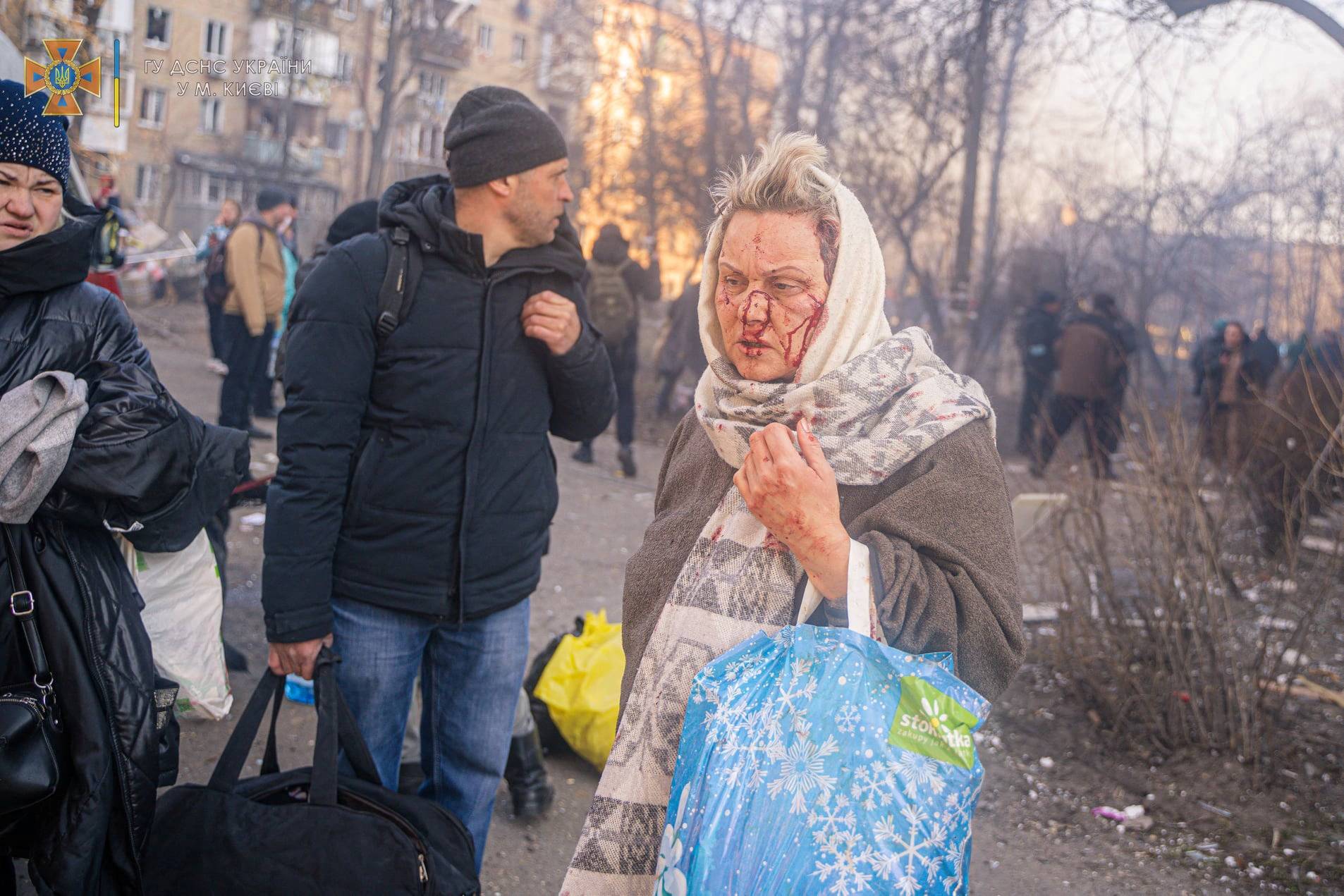 An injured woman is evacuated from a building damaged by shelling in Kyiv