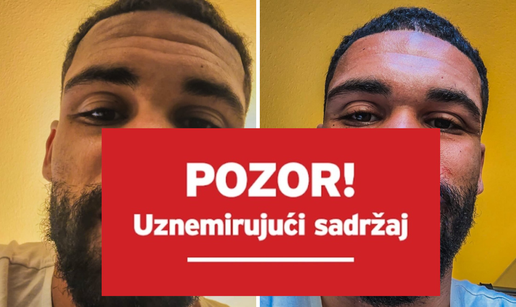 Modri&cacute;ev suigra&ccaron; &scaron;okirao je fotkom nakon stravi&ccaron;ne ozljede