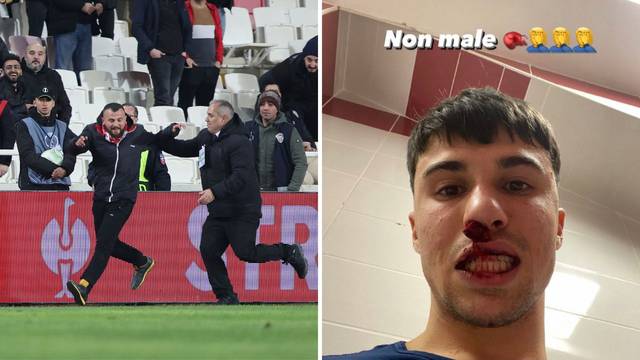 Kaos u Turskoj: Huligan upao u teren i razbio nos igraču 'viola'