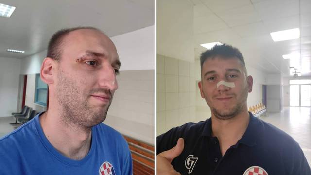 Ovo boli više od poraza: Igrači Dinama nakon utakmice završili u bolnici s razbijenim glavama
