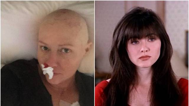 Brenda iz 'Beverly Hillsa' otkrila kako izgleda nakon gubitka kose, godinama se bori s rakom