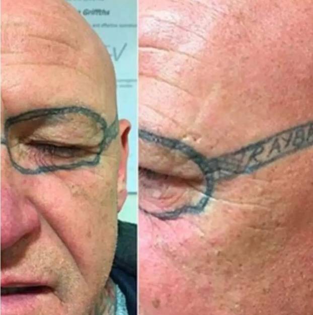 FOTO Tetoviraj me nježno! Ovo su neki od najbizarnijih 'crteža'