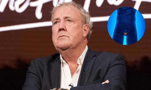 Jeremy Clarkson ima rak prostate: Ovo su rani simptomi koje mu&scaron;karci &ccaron;esto ignoriraju