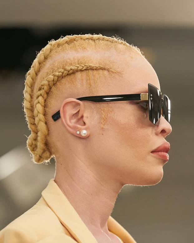 FOTO Afrikanka s albinizmom osvaja modnu industriju: 'Često privlačim znatiželjne poglede'