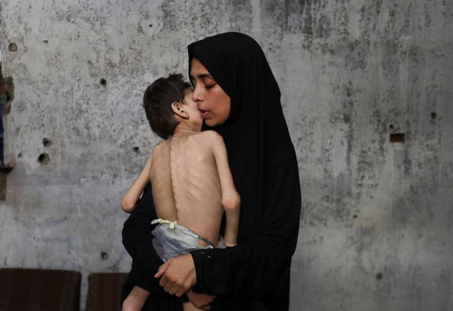 Displaced Palestinian mother Samah Matar holds her malnourished son Youssef, in Gaza City